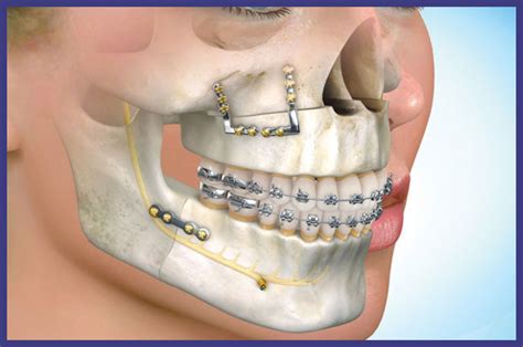 Surgical Dentistry Denta Kings