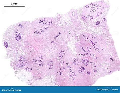 Human Breast Stock Image Image Of Micrograph Stroma 288379531