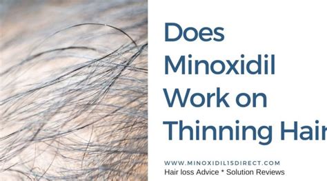 Slsilk How Long For Sulfatrim To Work Excellent Does Minoxidil Help Hair Regrowth Confirm