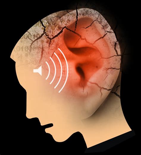 Tinnitus All You Need To Know About The Ringing In Your Ears