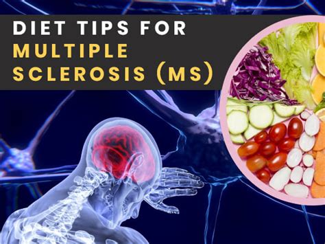 Multiple Sclerosis Ms Diet Plan Foods To Eat And Foods To Avoid