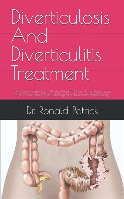 Buy Diverticulosis And Diverticulitis The Ultimate Guide On All You