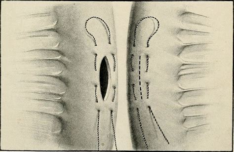 Image From Page 358 Of Operative Surgery For Students An Flickr
