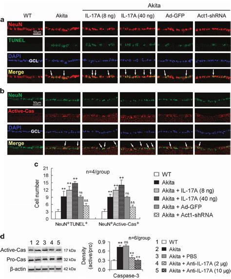 Il 17a Increases Retinal Ganglion Cell Apoptosis In Akita Mice Via Act1