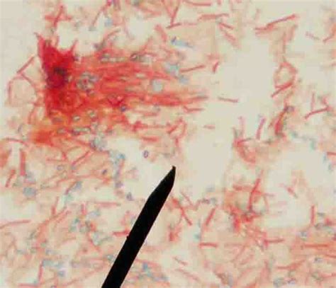 Endospore Bacterial Stain Microbiology Images Photographs From The