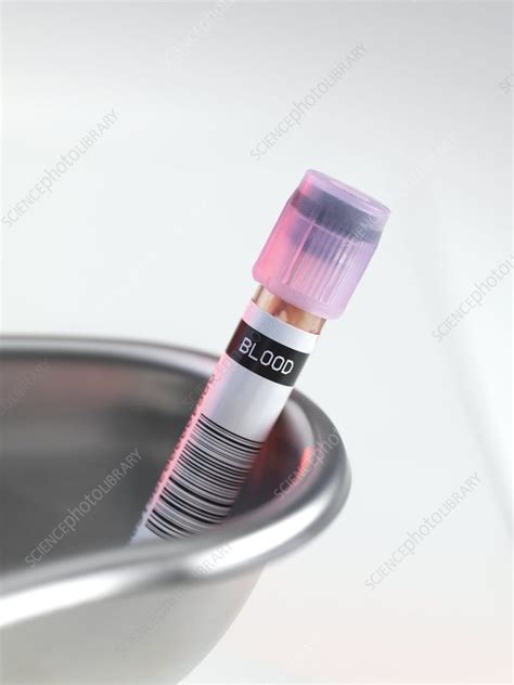 Blood Sample Stock Image F0027226 Science Photo Library