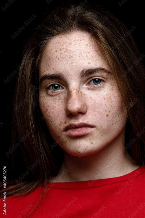 Freckled Face Freckles Woman Portrait Close Up Beautiful Blue Eyed Girl With Freckles Is