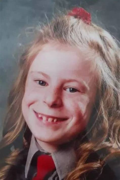 Irish Schoolgirl Died After Doctors Cut Away 17 Of Her Body