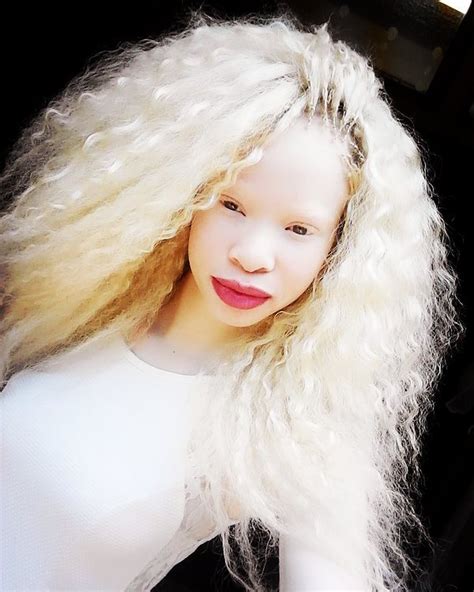 Nontobeko Mbuyazi Albino Model Barbie Doll Hairstyles Albino Girl