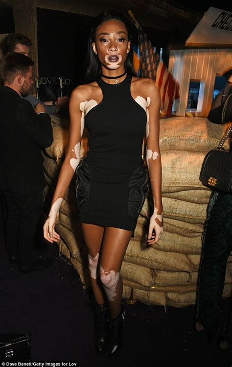 Winnie Harlow Flaunts Her Perfect Figure At London Fashion Week Party