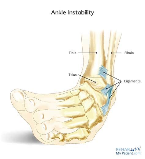 Ankle Instability Rehab My Patient