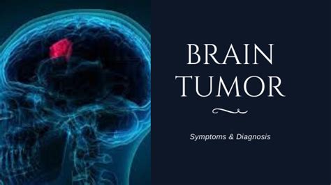 Brain Tumor Symptoms Diagnosis And Treatment Medical Darpan