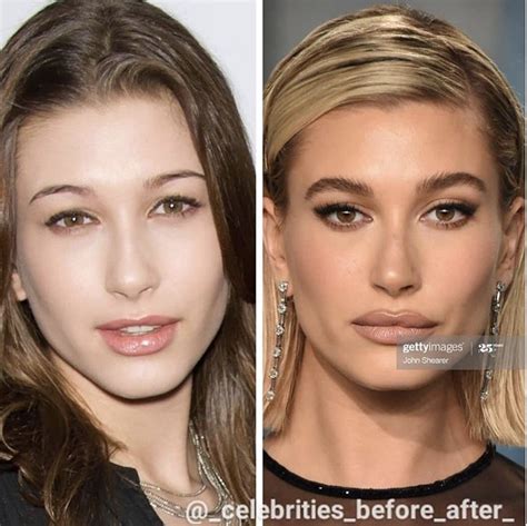 Hailey Bieber How To Make Hair Celebrities Before And After