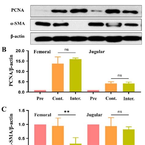 pcna and α sma expression related to smooth muscle cell proliferation download scientific