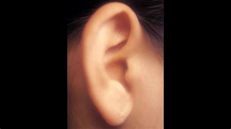 Ear Cancer Symptoms Youtube