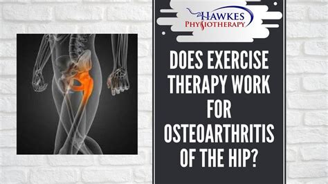 Does Exercise Therapy Work For Osteoarthritis Of The Hip