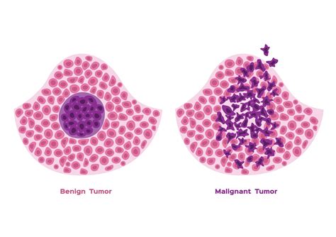 Lung Cancer Cells Vs Normal Cells