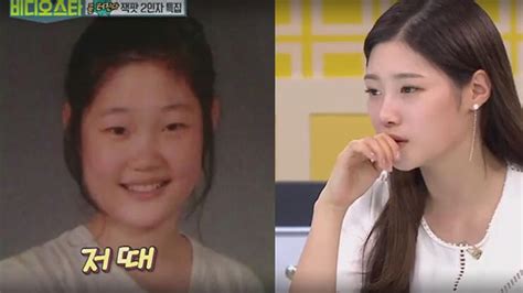 5 Idols Who Admitted To Plastic Surgery Sbs Popasia