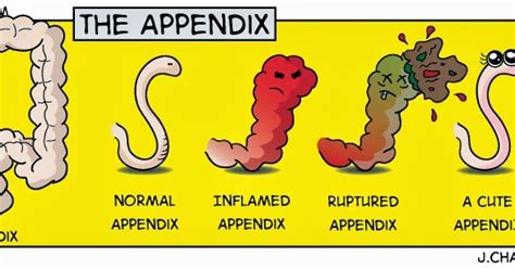 Poor Md Appendix Comic