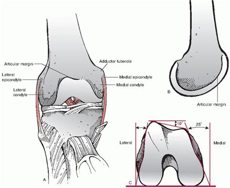 Distal Femur Fractures Teachme Orthopedics