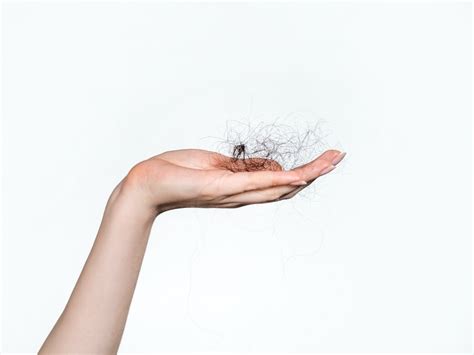 Hair Loss Treatments for Women關於女性脫髮 ELLE HK