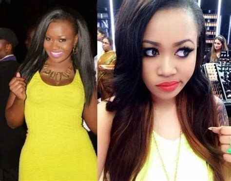 10 Photos Of Vera Sidika Before And After 15m Skin Surgery Youth