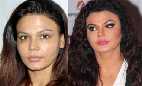 Years ago when she appeared as a contestant on bigg boss' first season both her kidneys had failed since a year (and she was surviving for a year, miracle before miracle). Rakhi-Sawant-before-after-plastic-surgery - THE EMERGING INDIA