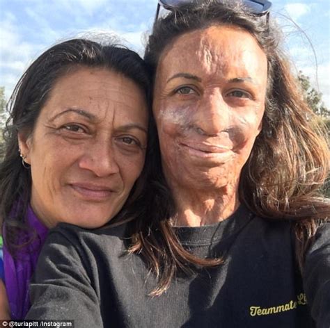 Turia Pitt S Mum Had Her Books Rejected By A Publisher Daily Mail Online