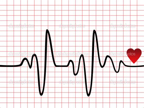 Heart Monitor Clipart Free Download On Clipartmag