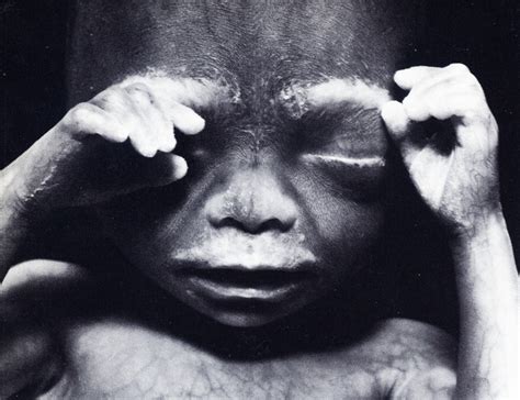 A guide to holistic therapies for pregnancy birth and early childhood. Lennart Nilsson A Child is Born — DOP