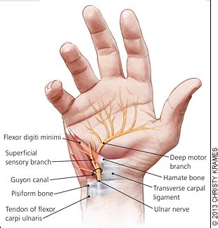 Cyst In Ulnar Styloid Of Thumb Adult Hq Pics Comments