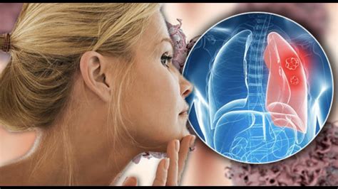 9 Warning Signs Of Lung Cancer You Might Ignore Youtube