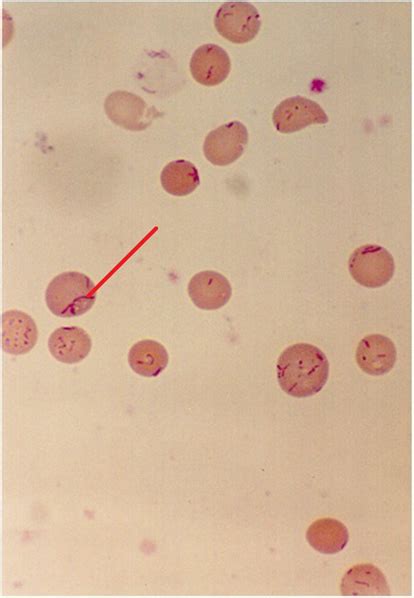 Bartonella Bacilliformis Pdf