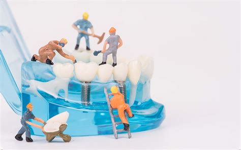Dental Implant Alternatives Nha Khoa Sydney