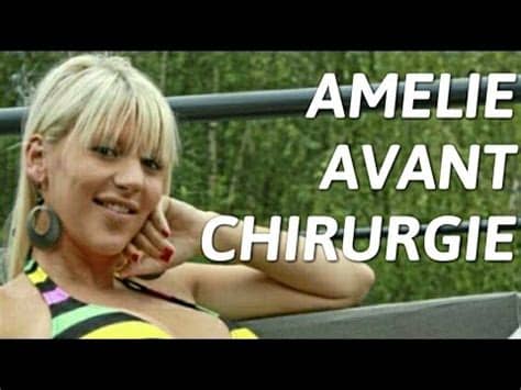 Aurélie dotremont a récemment été au cœur d'une polémique concernant la chirurgie esthétique ! AMELiE - AVANT CHIRURGIE ! - YouTube