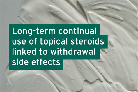 Long Term Continual Use Of Topical Steroids Linked To Skin Withdrawal