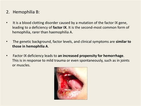 Bleeding And Clotting Disorders Powerpoint Slides