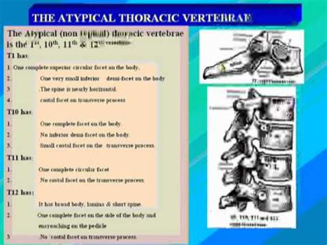 What do you prefer to learn with? 05- The Atypical Thoracic Vertebrae - YouTube