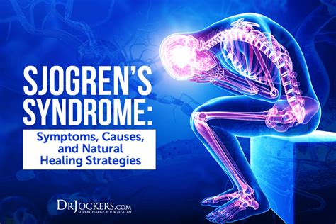 Sjogrens Syndrome Symptoms Causes And Natural Support Strategies In