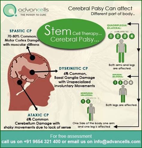 Stemcells Therapy For Cerebral Palsy Stem Cell Therapy Motor Cortex