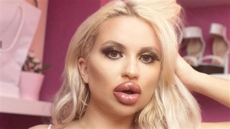 Woman Spends 43000 On Plastic Surgery To Look Like Barbie Daily