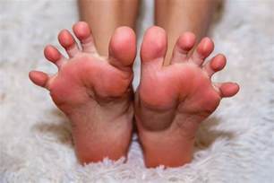 White Spots On Feet