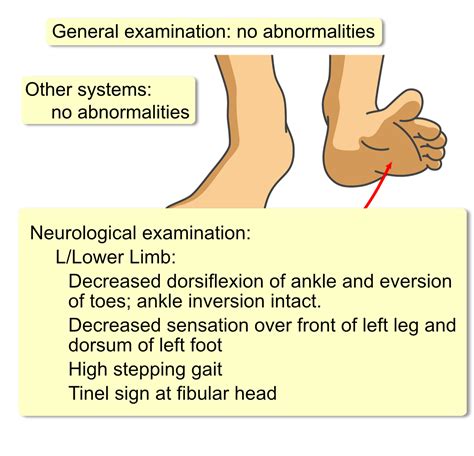 Peroneal Nerve Foot Drop