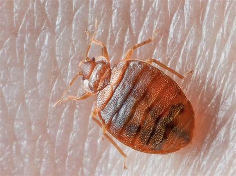 Bed Bugs Bed Bug Bites How To Get Rid Of Bed Bugs