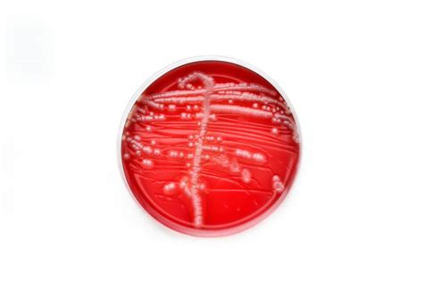 120 Ecoli Bacterial Colonies On Macconkey Agar Plate Stock Photos