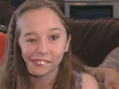 Teen With Facial Deformity Finds Reason To Smile Newsnow