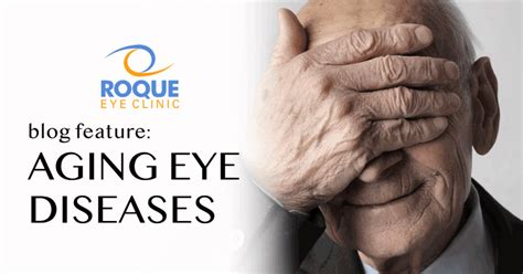 Aging Eye Diseases And Conditions Roque Eye Clinic