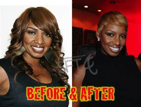 Before And After Nene Leakes Admits To Plastic Surgery Nene 2 0 [photos Video] Straight