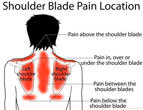Left Upper Back Pain Under Shoulder Blade Surfeaker