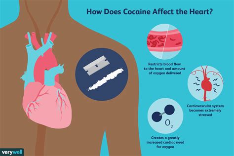 Cómo afecta la cocaína al sistema cardiovascular Medicina Básica